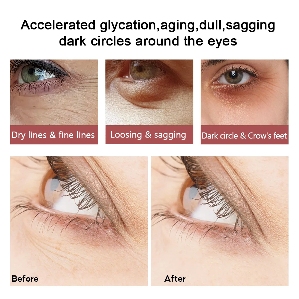 2PCS 20g Peptide Collagen Eye Cream Anti-Wrinkle Anti-Aging Remove Dark Circles Eye Skin Care