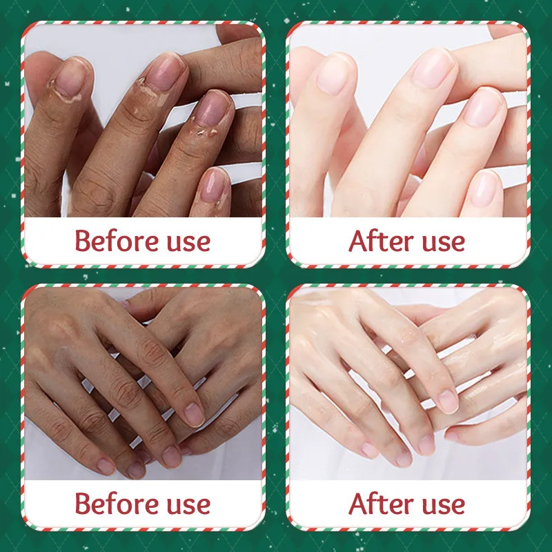 Moisturizing and Anti Cracking Hand Cream 5 Piece Set for Christmas Gift Box