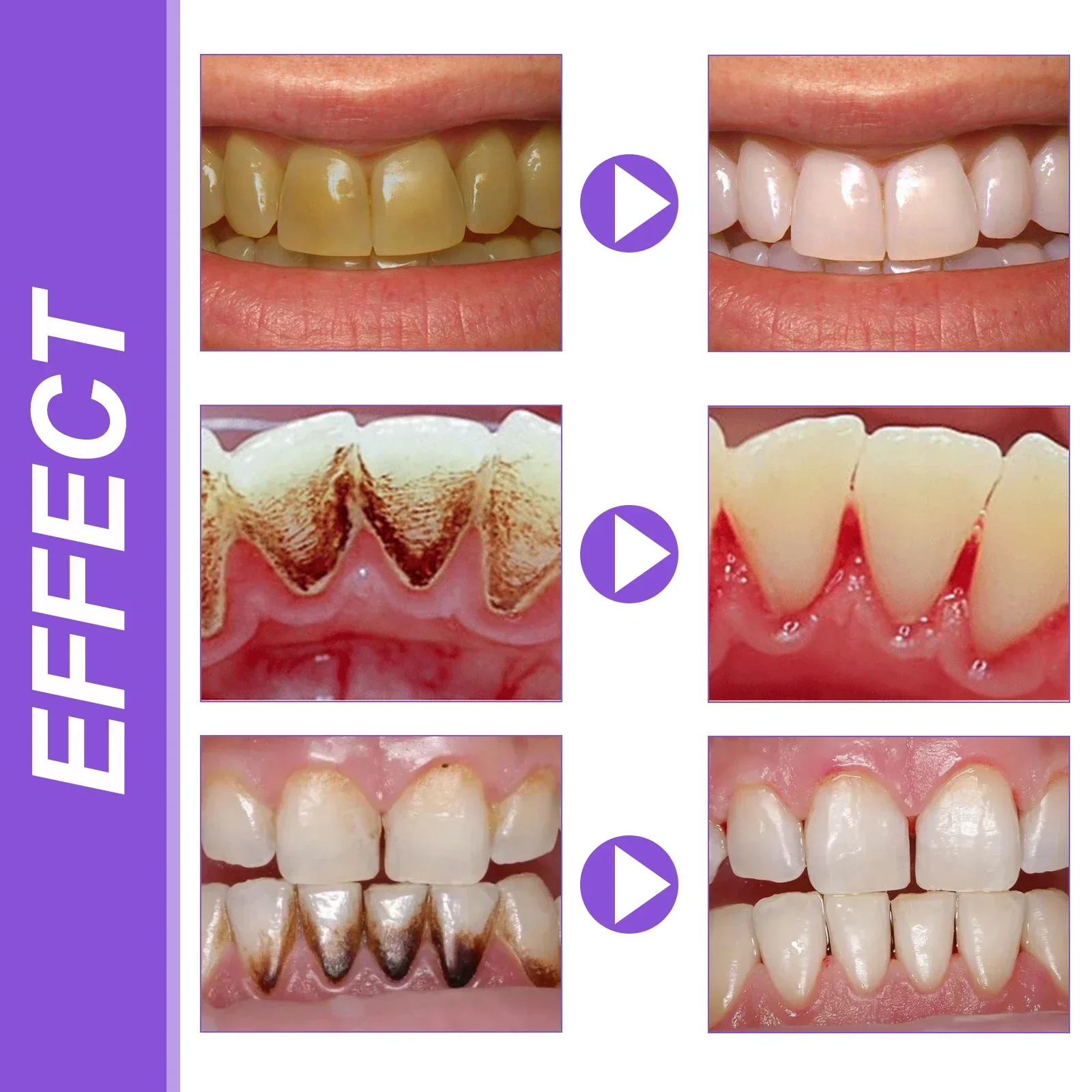 Purple Whitening Toothpaste for Fresh Breath and Care