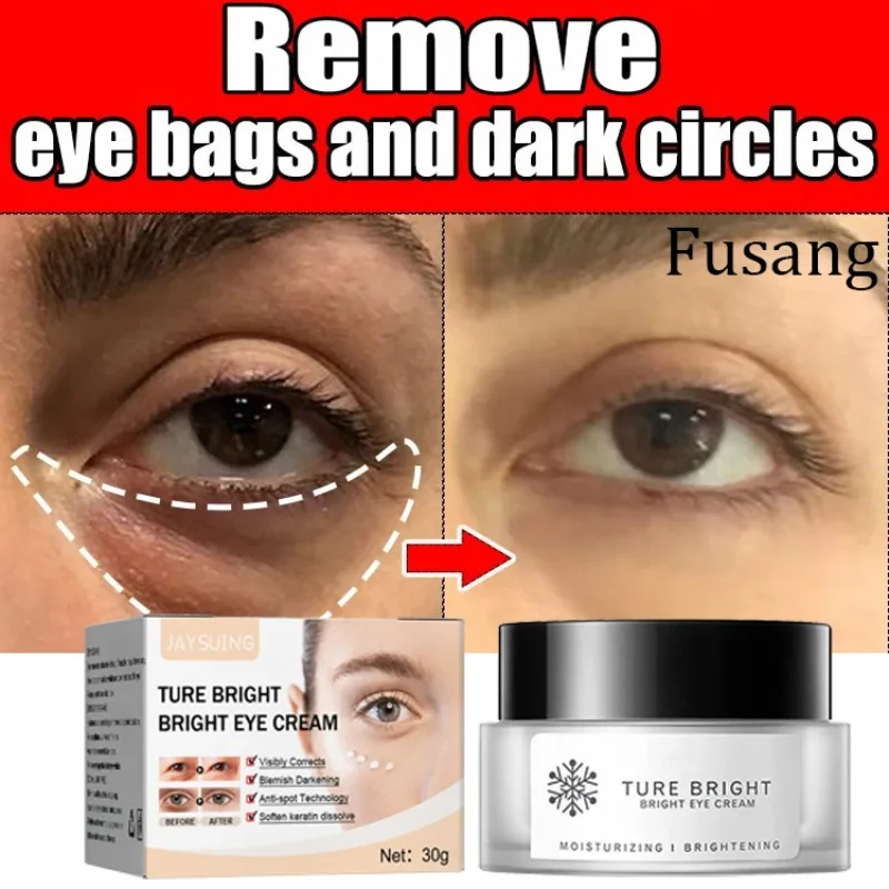 Retinol Remove Dark Circles Cream Fast Remove Eye Bag Cream Face Puffiness Eyes Serum Fade Fine Lines Women Anti Aging Cream