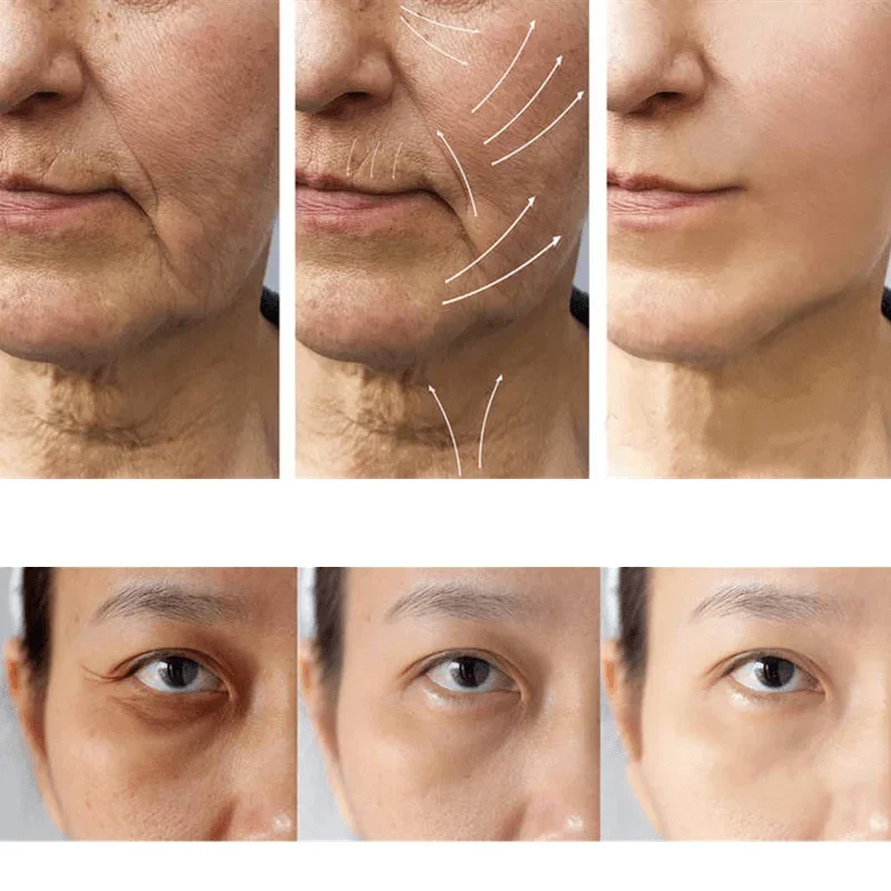 Wrinkle Remove Face Serum for Anti-Aging Skin Care