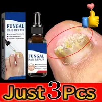 Fungal Nail Laser Treatment Device Repair Toenail Anti Infection Paronychia Onychomycosis Ingrown Toenail Foot Care Essence 1