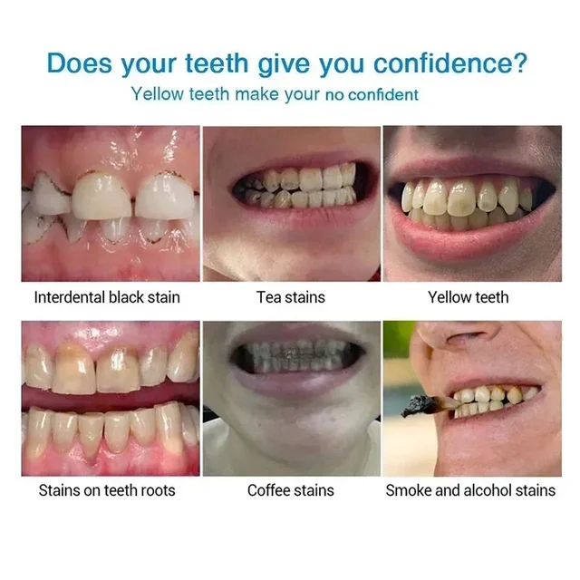 Dental Calculus Remover Teeth Whitening Spray Toothpaste Cleaning Oral Hygiene Removal Halitosis Plaque Stains Fresh Breath Care 2