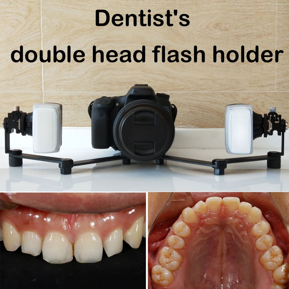 OralMacroPhotographyBracketSimulationDualHeadFlashRingFlash