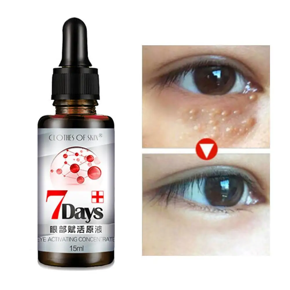 15ml Eye Revitalizing Solution Dilute Dark Circles Remove Cream Anti grains lines Anti-ag Remove Fat Lighten Eye Bag Eye Cream farm stay dr v8 solution caviar cream 50 мл 3 варианта