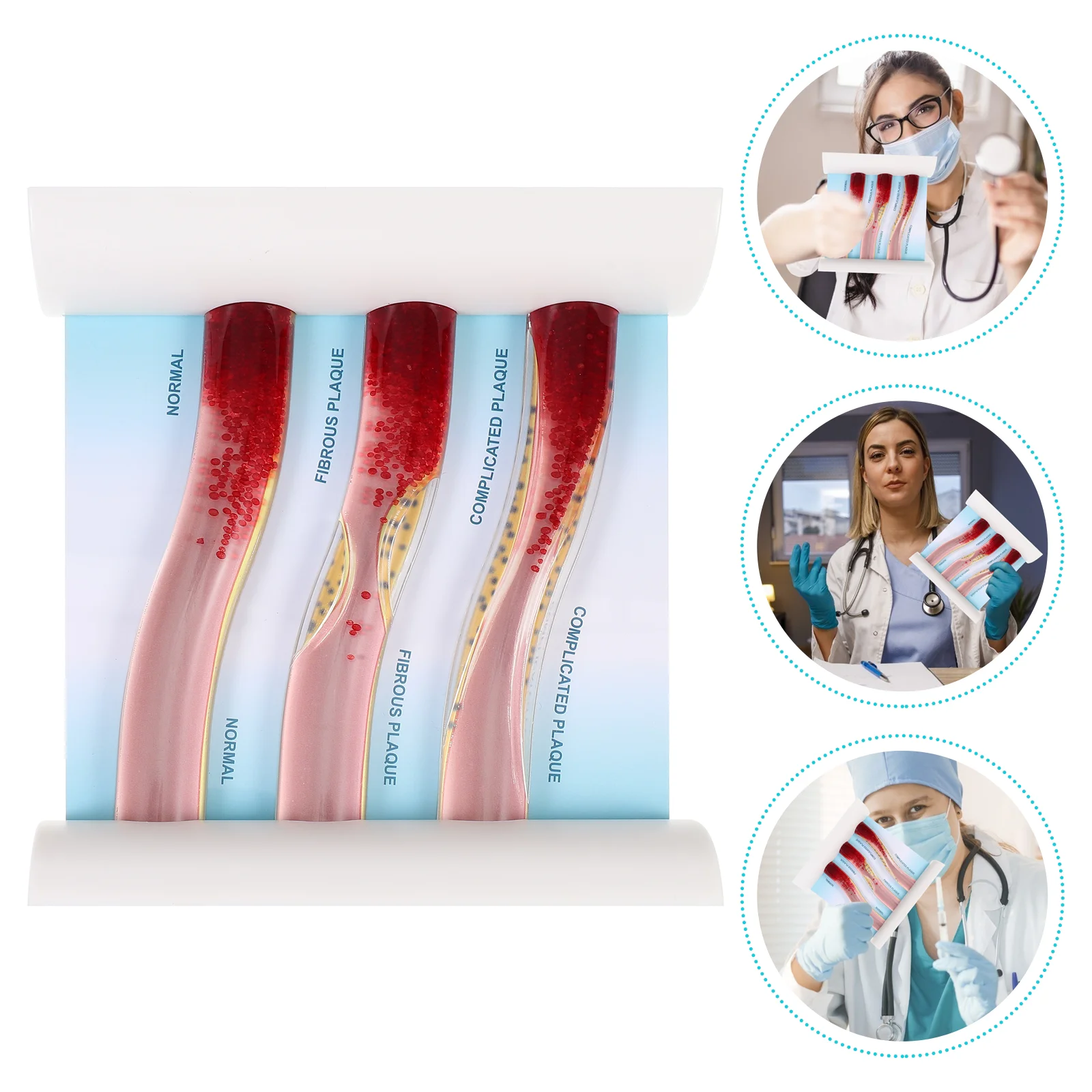 

Vascular Model Teaching Manikin Blood Vessel Anatomical Mannequin Low Density LDL