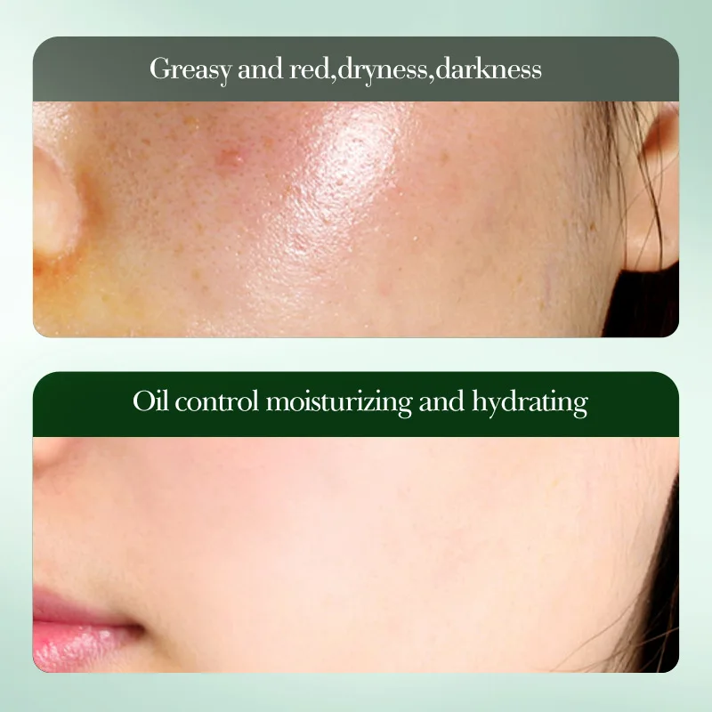 Centella Asiatica Amino Acid Gentle Purifying Cleanser Oil Control Moisturizing Pore Cleansing Cleanser