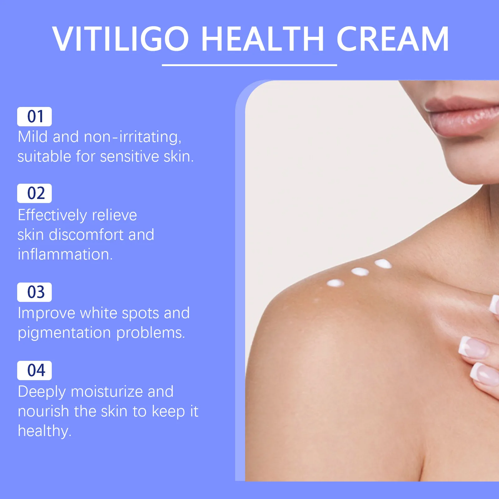 Vitiligo Ointment Remove Mycosis Ringworm White Spot Melanin Growth Antibacterial Improve Leukoplakia Disease Eliminate Vitiligo