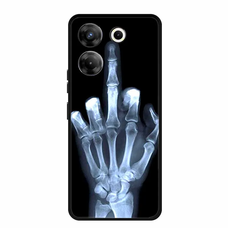 WIMSPEED Custodia per Tecno Camon 20 PRO 5G (6.50) + 2 PCS Pellicola