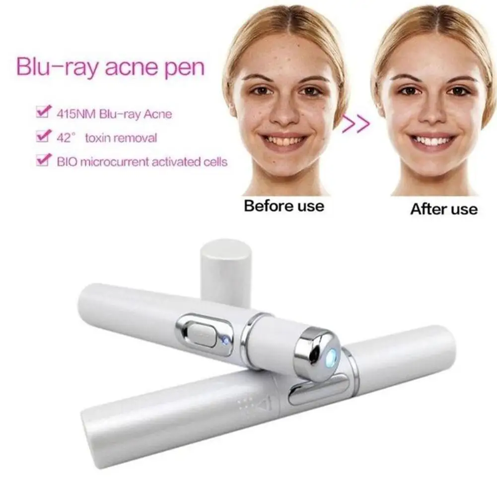 Blue Light BIO Micro Current Therapy Acne Laser Ball Roller Pen Soft Scar Wrinkle Removal Device For Skin Care Tool 5