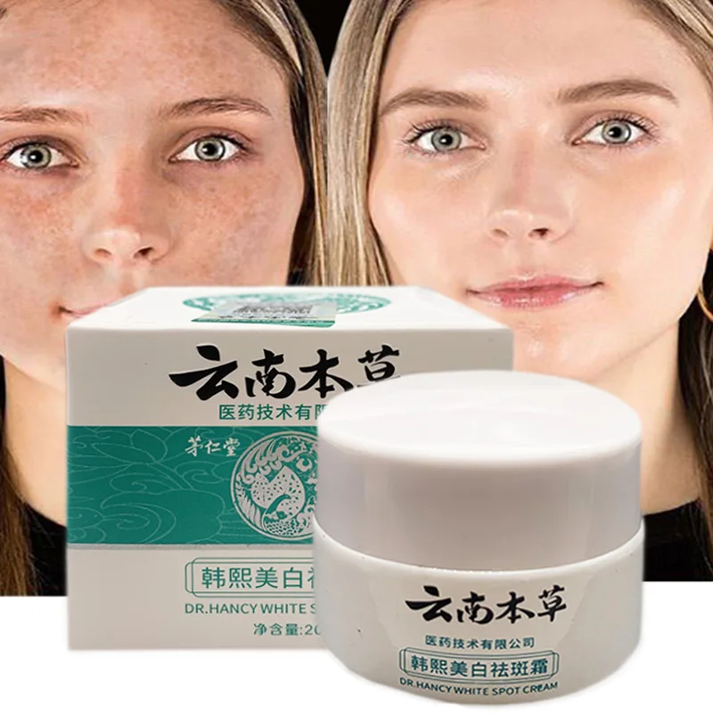 

20g Whitening Freckle Cream Moisturizing Cream Skin Reduce Melanin Care Remove Melasma Acne Spot Pigment Dark Spots Dressing