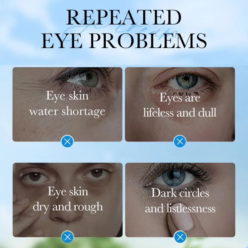 SADOER Coconut Eye Cream Moisturizing Anti Dark Circles Anti Wrinkles Ant-Aging Whitening Eyes Skin Care Products