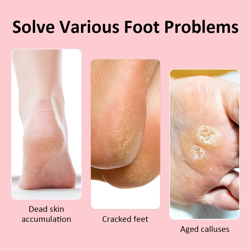 Electric Pedicure Machine Foot Grinder Pedicure Tools Foot File Callus Remover Skin Care for Heels Dead Skin Remover 5