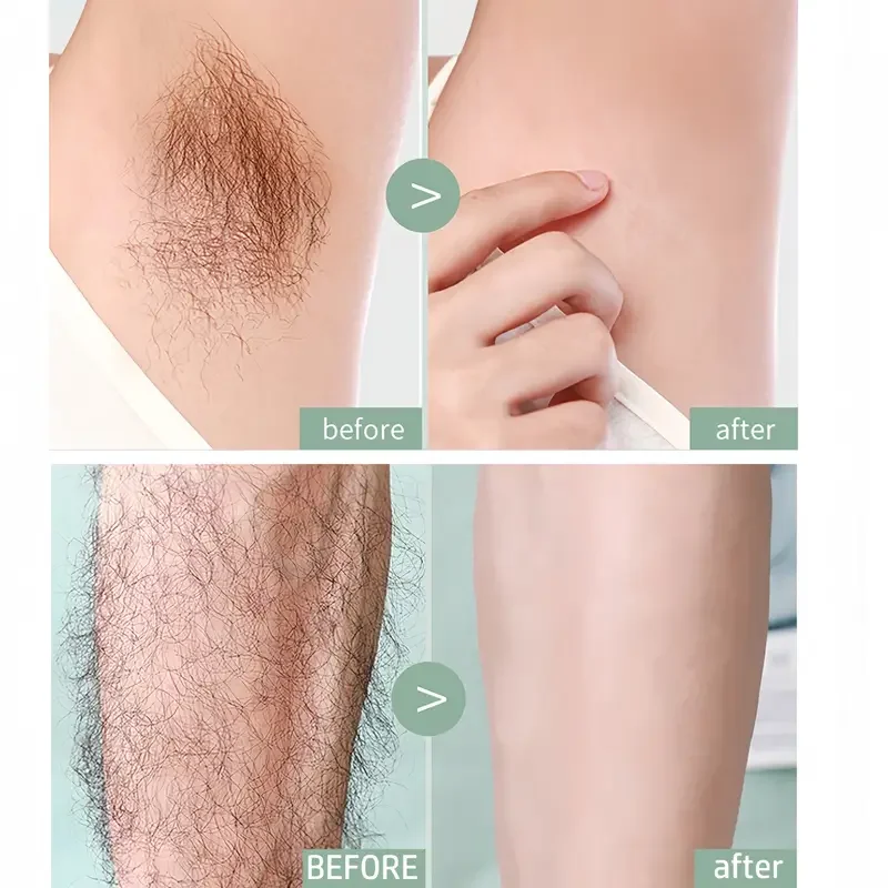 Portable Painless Hair Trimmer Device for Easy Hair Removal