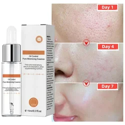 Pore Shrinking Serum Face Removing Large Pores Tightening Repairing Facial Pore Minimizing Essence Get Rid Acne Marks Temperate