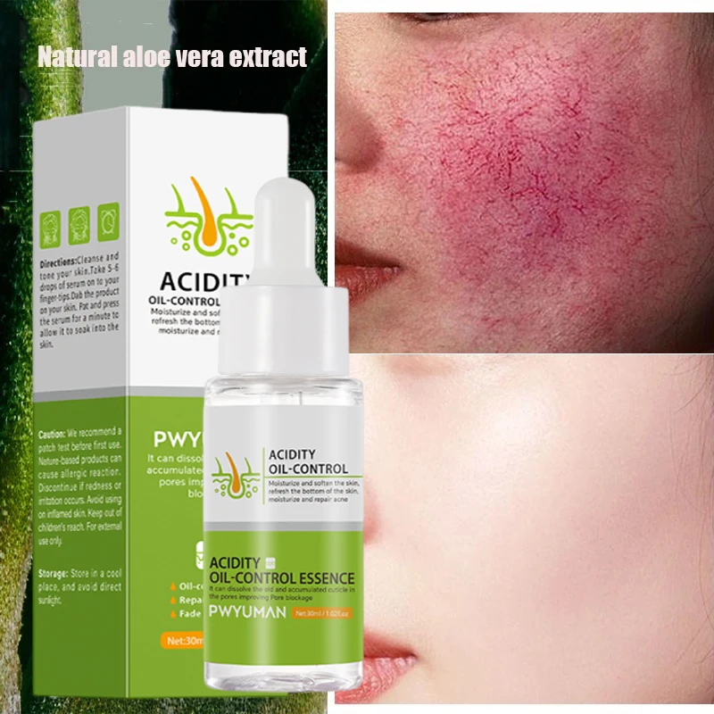 Facial Serum Facial Essence Retinol Face Serum Salicylic Acid Facial Serum for Repair Facial Redness Spider Vein Remove Sensitive Skin Sooth Anti Redness Rosacea Treat