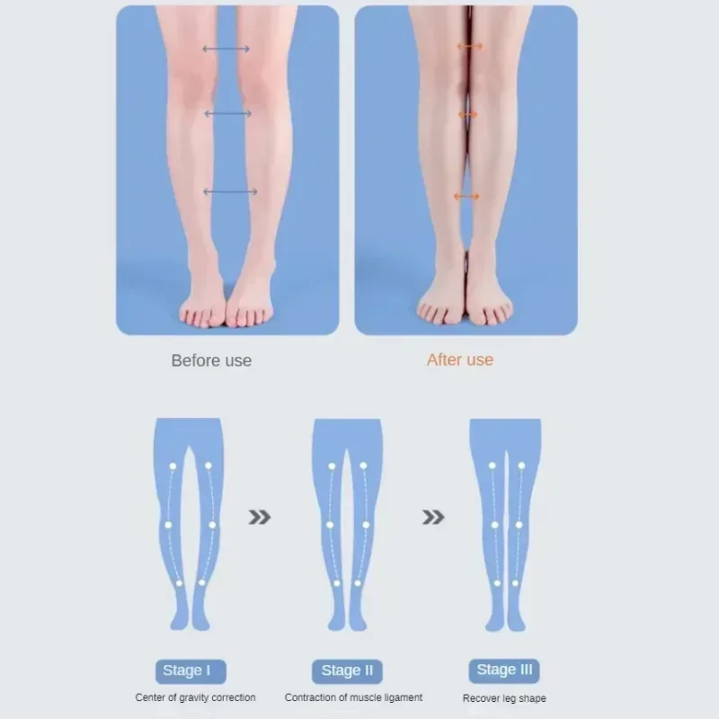 Orthotic insoles shoe insoles orthopedic insoles 1Pair O/X-Leg orthopedic insoles arch support for flat feet adults kids