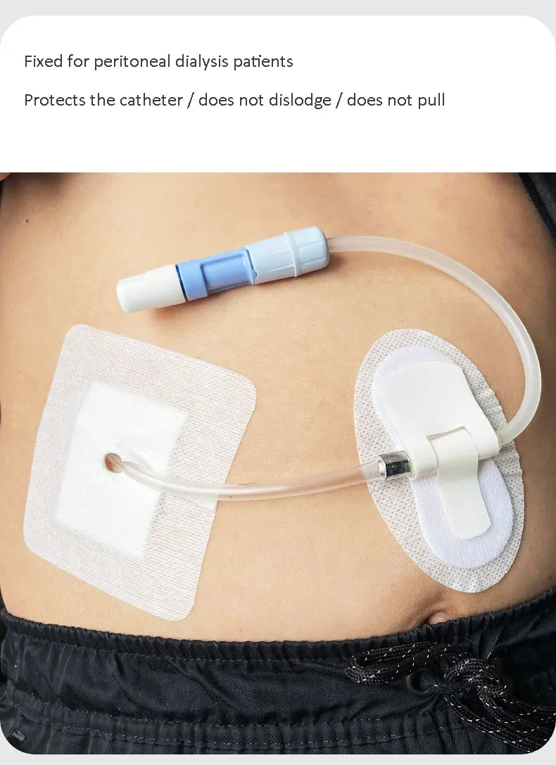 Drainage Tube Sterile Applicator Peritoneal Dialysis, 46 OFF