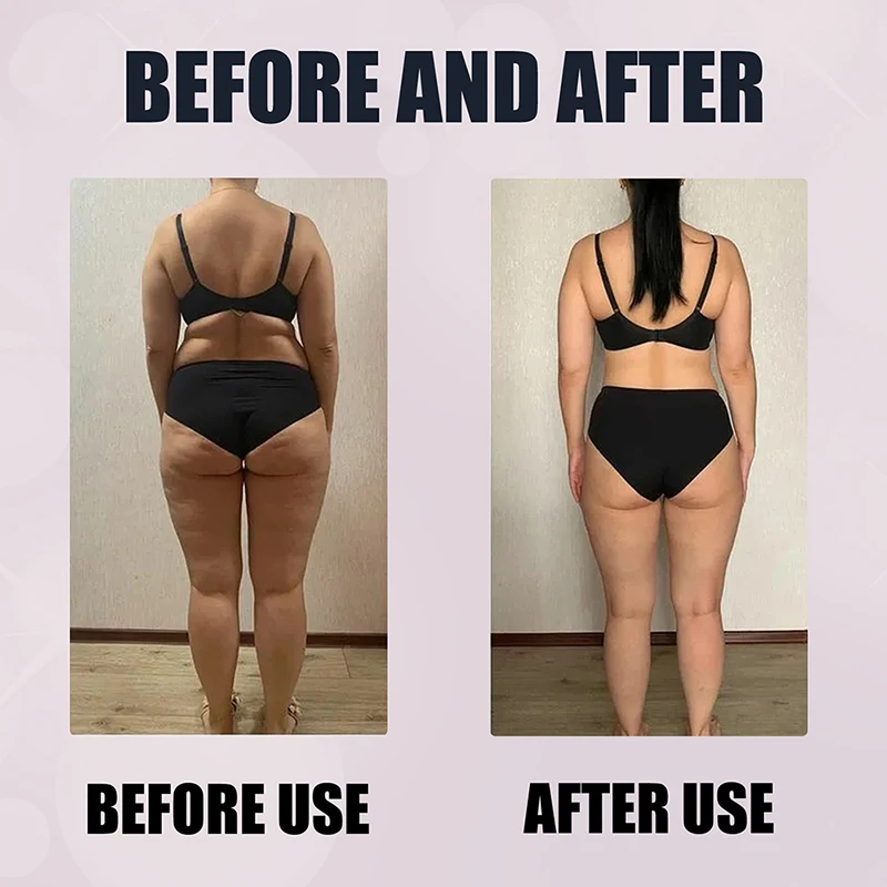 Weight Loss Products 15/30/50pcs Fat Burning Patch Belly Stickers Slimming Body Detox Navel Thigh Muscle Arm