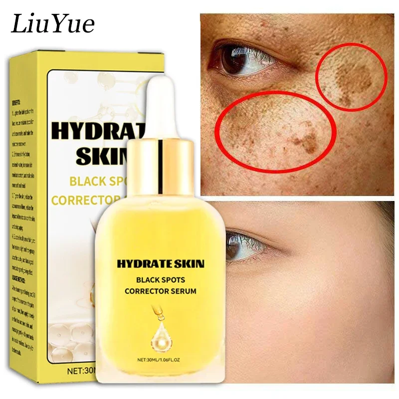 

Niacinamide Whiten Freckle Cream Lighten Dark Spots Essence Brighten Anti-spot Serum Spots Corrector Fade Melanin Face Skin Care