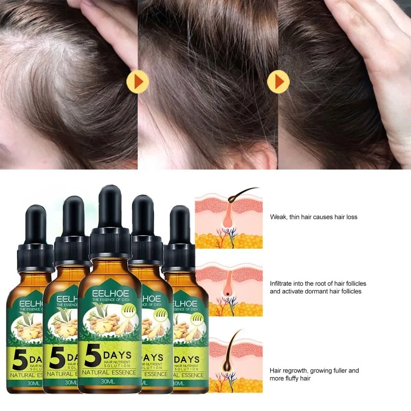 Ginger Hair Care Essential Oil Improves Scalp Environment Hair Loss Treatment Hair Growth Serum Increase Cream Head Essence 30ml anti alopecia fast hair growth oil ginger essential serum hairless baldhead increase high hairline head hair essence cream