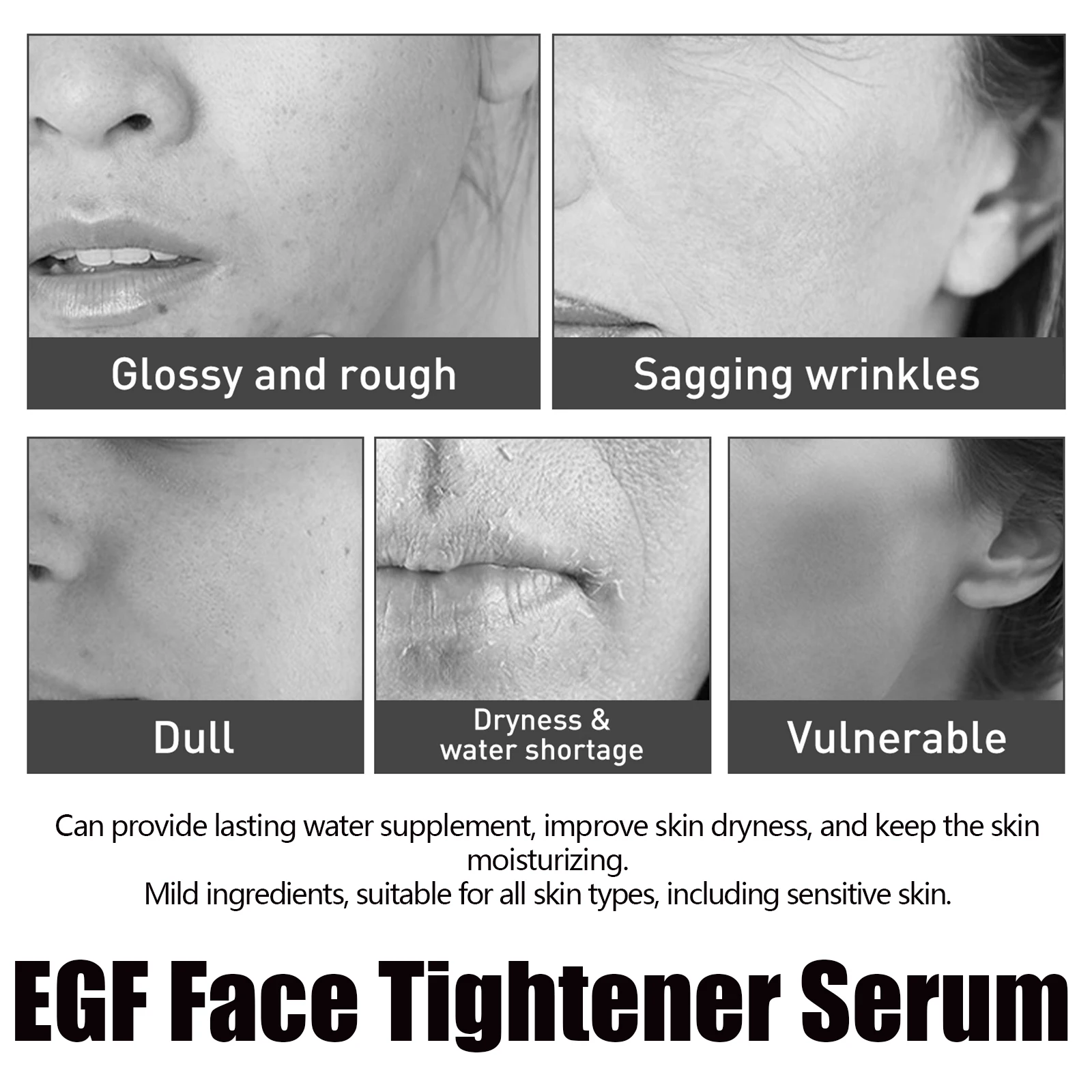 Egf Face Tightener Serum Improve Skin Dryness Fade Fine Lines Wrinkle Collagen Peptides Moisturizing Rejuvenation Facial Essence 4