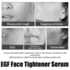 Egf Face Tightener Serum Improve Skin Dryness Fade Fine Lines Wrinkle Collagen Peptides Moisturizing Rejuvenation Facial Essence 4
