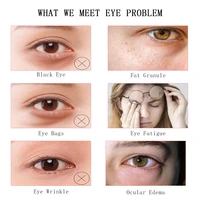 Mini BB Eyes Machine Face Lifting Tightening Beauty Device Removal Wrinkles Eyebags Dark Circles EMS Eye Massager Beauty Salon 2