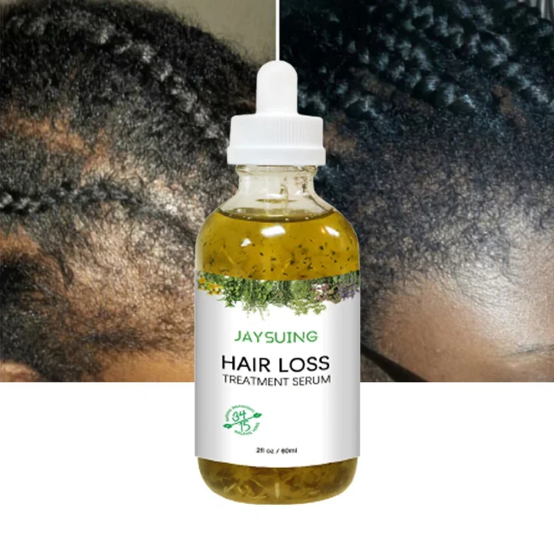 Fast Hair Growth Serum African Crazy Traction Alopecia Anti Hair Loss Essential Oil Prevent Baldness Scalp Treatment Hair Care