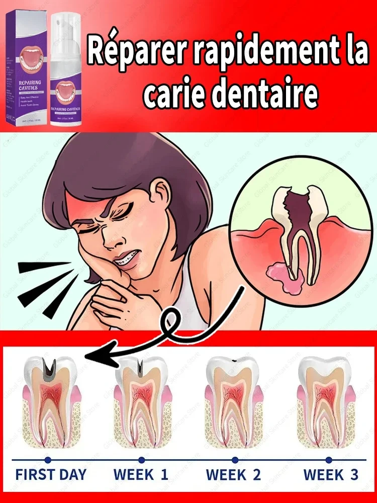 Toothpaste for Teeth Whitening Cavities Caries Removal Plaque Stains Decay Repair Dental Calculus