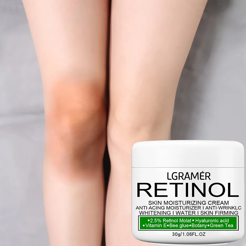 LGRAMER Retinol Brightening Cream for Private Part Brighten Dark Skin Permanent for The Whole Body Underarm Elbow Knee Buttocks 2