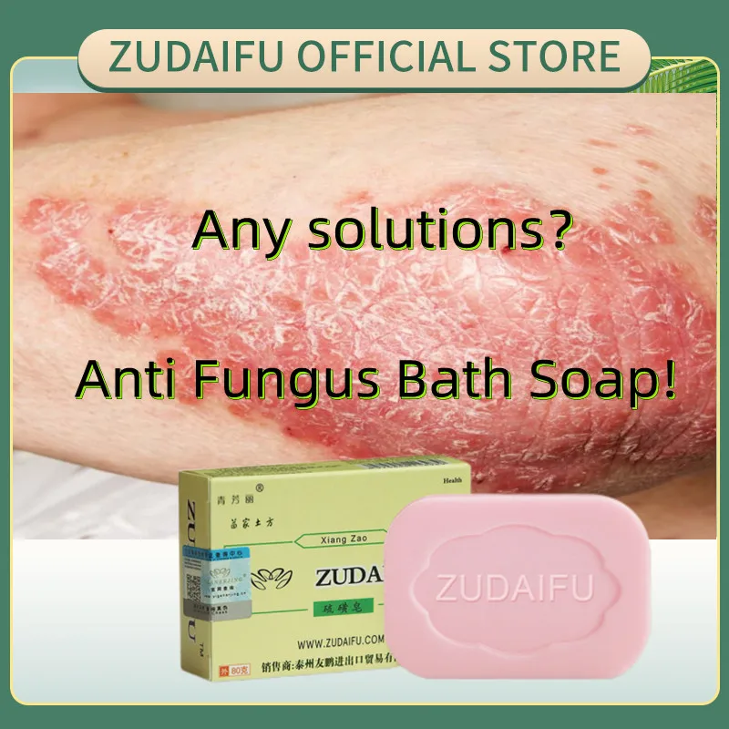 Remove Psoriasis Eczema Seborrhea Eczema Skin Conditions Acne Treatment
