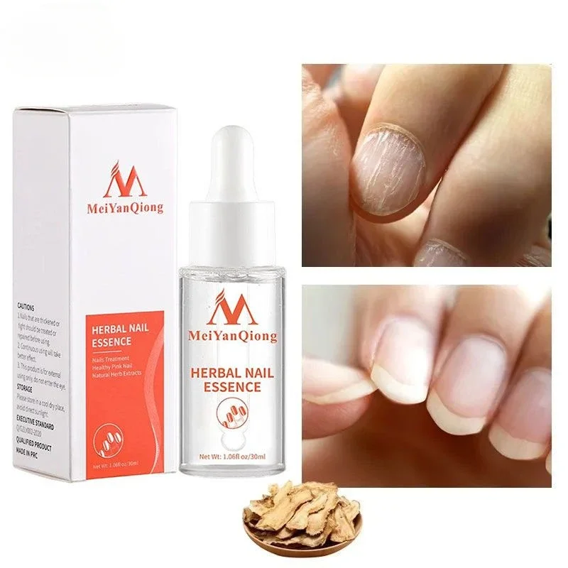 Toenail Repair Essence Anti Infection Nail Fungus Treatments Essence Feet Onychomycosis Repair Supply Unisex