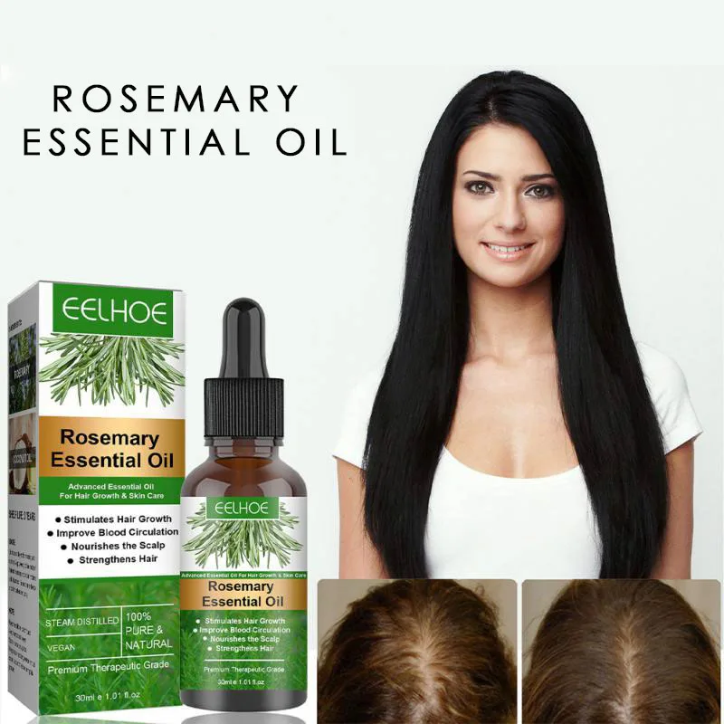 rosemary-hair-care-essential-oil-anti-hair-loss-repair-itching-split