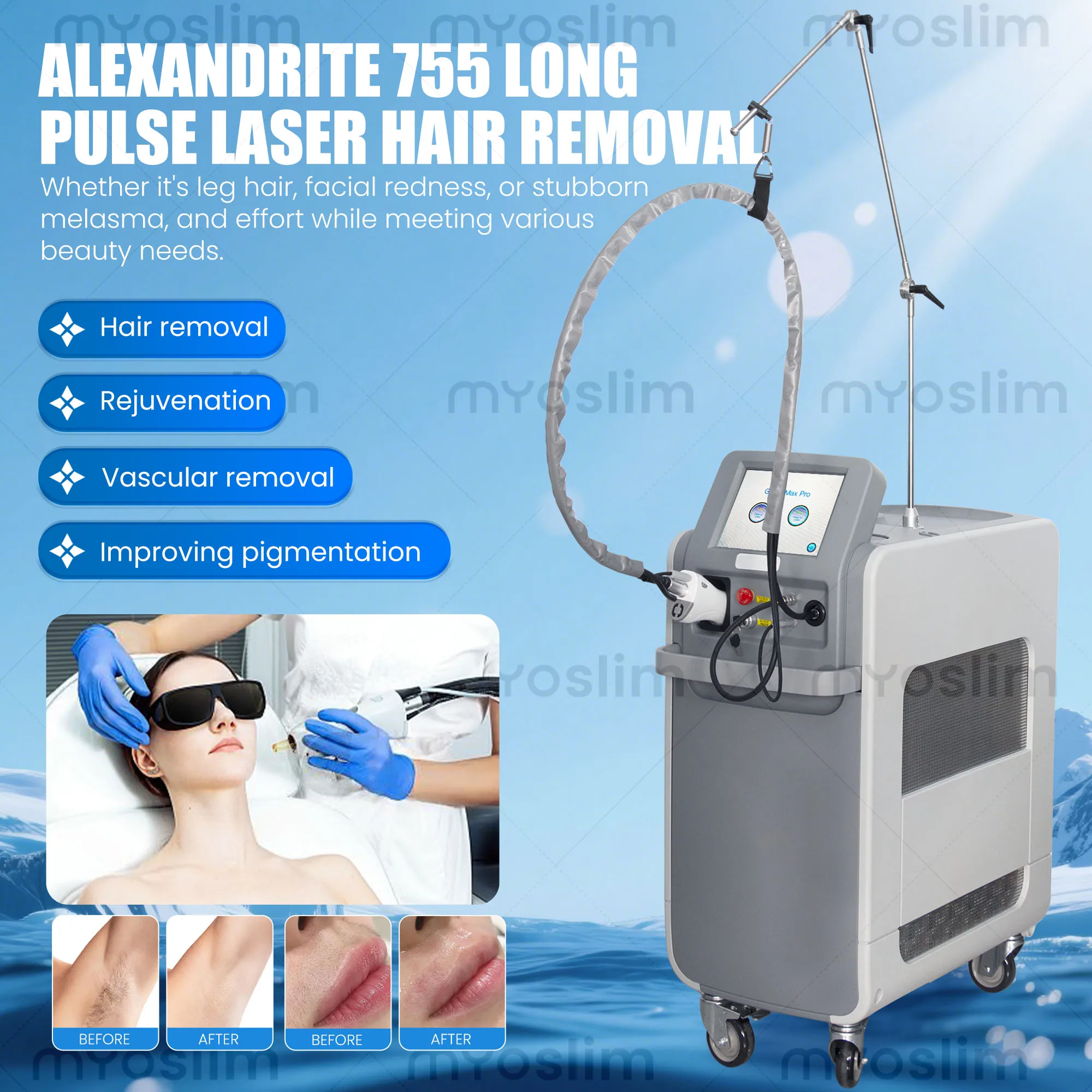 Rejuvenation Beauty Equipment Alexandrite 755nm Long Pulse Hair Removal Instrument 1064nm Fiber Optic Skin 6