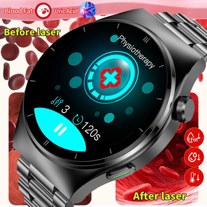 

2023 New Laser Physiotherapy Bluetooth Call Call Blood Lipids Uric Acid Health Smart Watch Men Accurate Blood Glucose Smartwatch