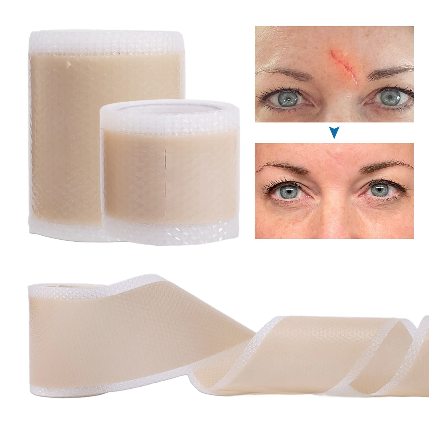 Silicone Scar Sheets Self Adhesive Waterproof Skin Tone Tattoo Accessories