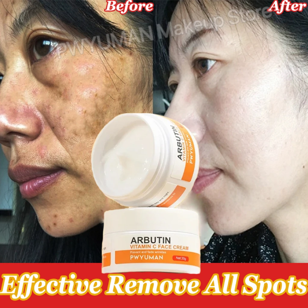 

Vitamin C Whitening Freckles Face Cream Remove Melasma Dark Spots Lighten Melanin Acne Scar Anti-aging Brighten Korean Skin Care
