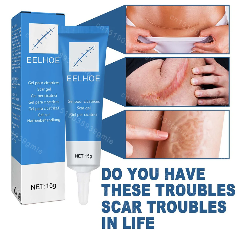 Scar repair gel fast recovery surgery Scar treatment Spot repair Soften stretch mark Burn Whitening body care Relief