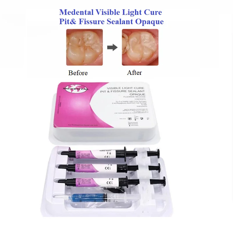 Medental Visible Light Cure Pit&Fissure Sealant Opaque C olor Change Dental Dental Pit And