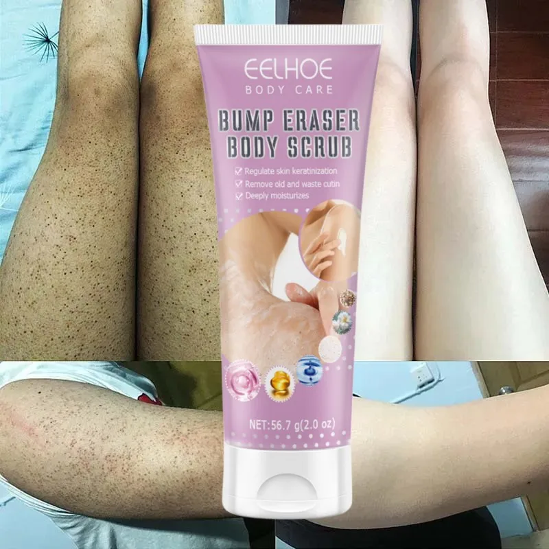 7-Day Fast Body Scrub Cream Moisturizing Skin Repair Keratosis Pilaris Removing Strawberry Legs Eraser Nourishing Body Skin Care скраб для тела клубника wokali strawberry sherbet body scrub 500 мл