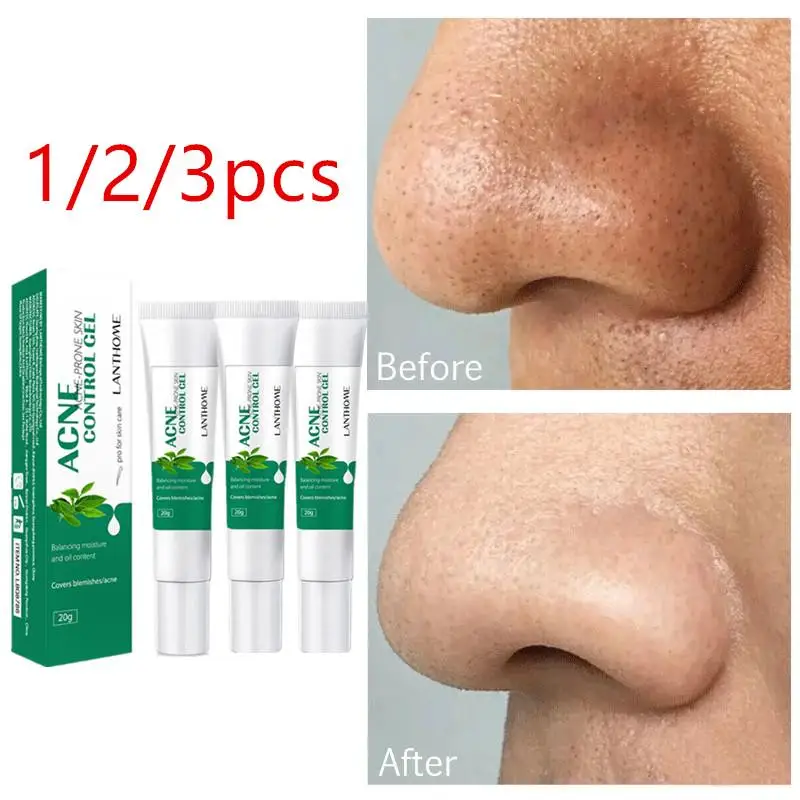 

1/2/3pcs Acne Eliminate Acne Mark Pore Contraction Oil Control Acne Cream Face Care Ointment Remove Freckle Cream