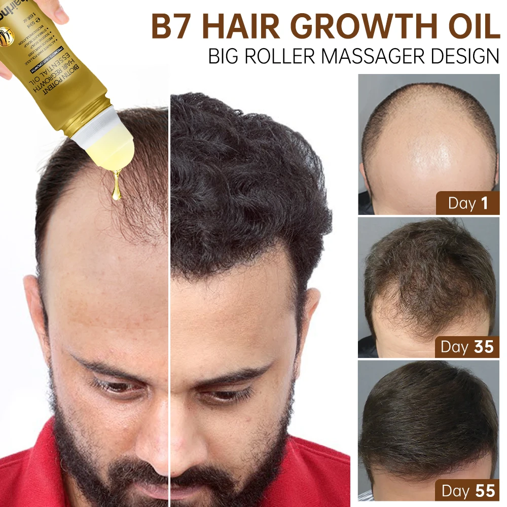 Top more than 149 vitamins that promote hair growth best tnbvietnam