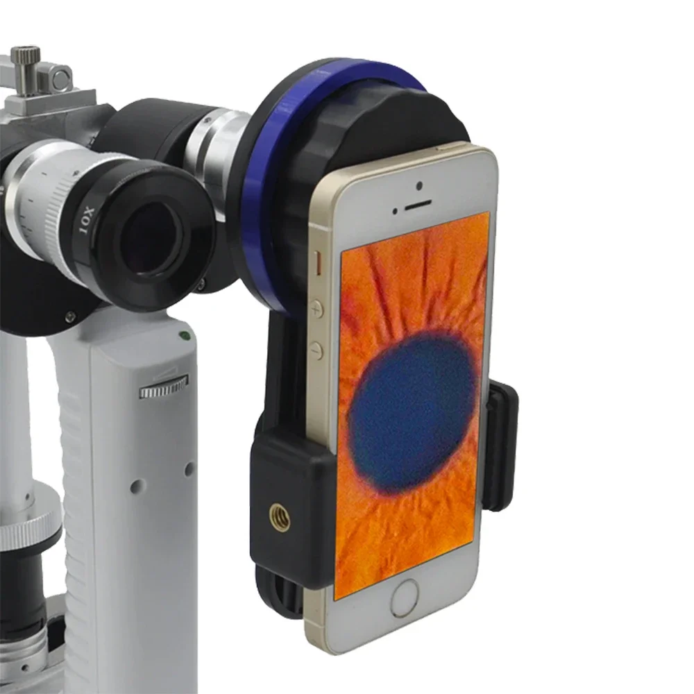 NEW VISION Universal Smartphone Photo Adapter For Slit Lamp
