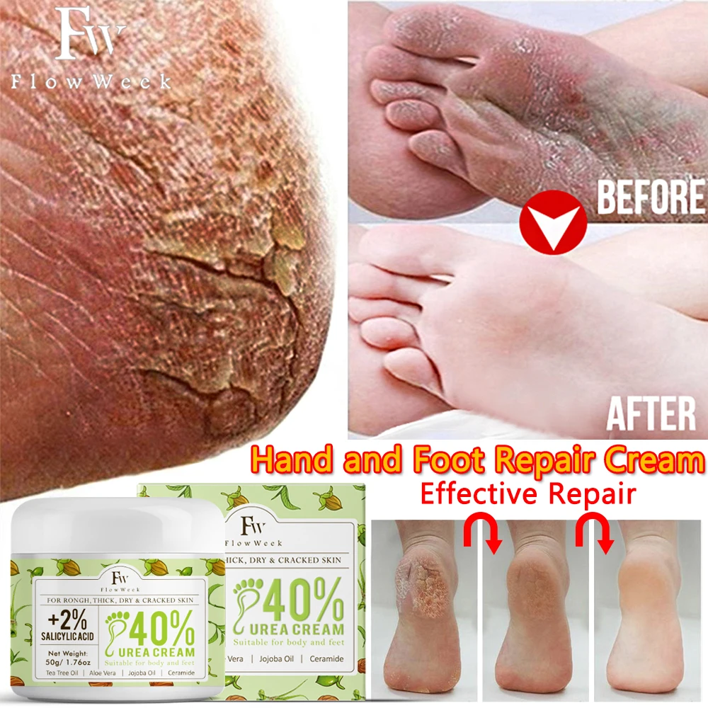 50g-anti-crack-foot-cream-anti-drying-heel-cracked-repair-calluses-dead-skin-removal-moisturizing-hand-feet-care-beauty-health