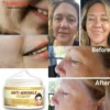 Masajeador Facial antiarrugas para el cuello, Lifting de microcorriente 4