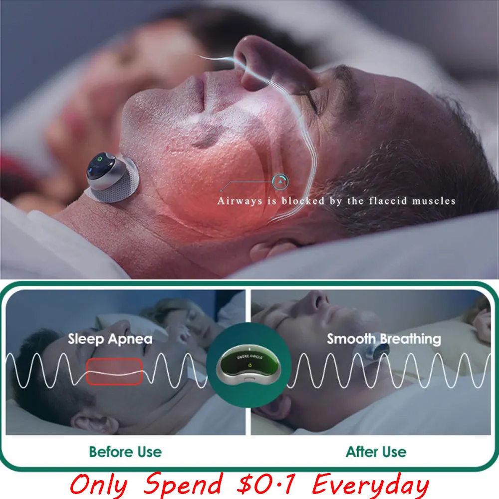 Bluetooth Charge Snore Stopper Smart Anti Snoring Sleep Apnea Prevention Ema+tems Muscle