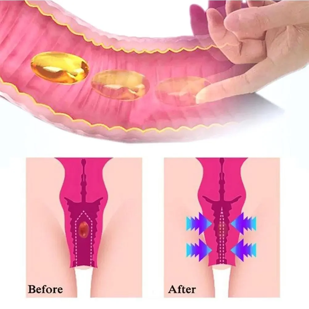 Slime Anti-itch Detox Slimming Capsule Body Shaping Capsule Firming Repair Arms Belly Female Body Care Weight Loss women probiotic capsules fat burning product