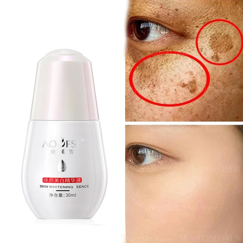 30ml Whitening Face Serum Freckle Removing Essence Improve Redness Lighten Melanin Brightening Skin Serum Reduce Dullness Spot biophytogenesis little green bottle serum skin care products soothing redness repair reduce acne marks color repair brightening