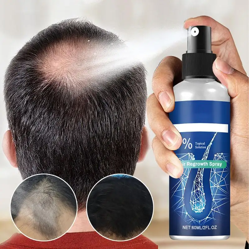 Hair Regrowth for Men 60ml Hair Growth Essence Growth Oil Portable Supplements Scalp Care Spray Hair Treatment Oil